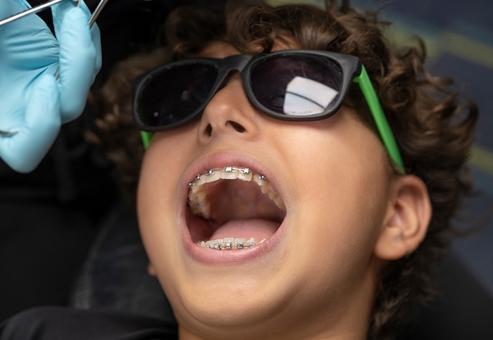 Adolescent Treatment