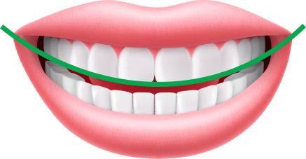 Assessment Smile Arc Orthodontics by Bradford in Palm Beach Gardens, Palm City, and Lake Worth, FL