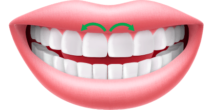 Assessment Tooth Gum Shape Orthodontics by Bradford in Palm Beach Gardens, Palm City, and Lake Worth, FL