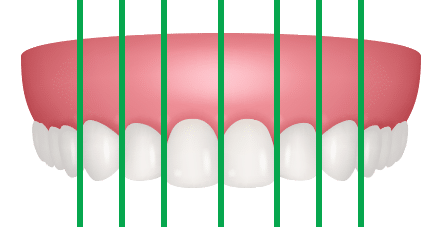 Assessment Tooth Shape Proportion Orthodontics by Bradford in Palm Beach Gardens, Palm City, and Lake Worth, FL