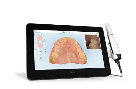 iTero Digital Scanner Orthodontics by Bradford in Palm Beach Gardens, Palm City, and Lake Worth, FL